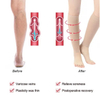 Enerup Compression Socks Without Feet Varicose Vein Treatment for Legs Pain