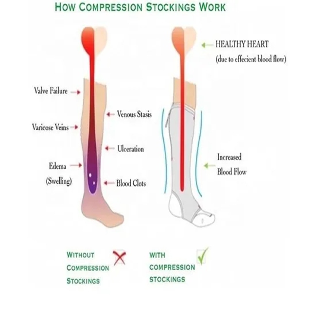 High Quality Women Sports Customized Zipper to Prevent Varicose Compression Socks