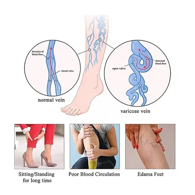 Ladies Compression Hosiery Leg Support Stockings Improve Varicose Medical Over Knee Socks 20-30mmhg