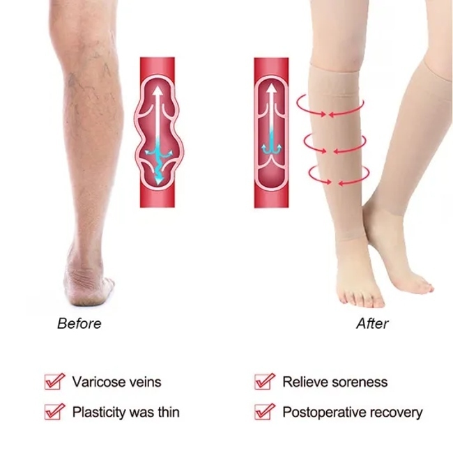 Enerup Compression Socks Without Feet Varicose Vein Treatment for Legs Pain