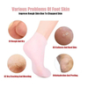 Silicone Socks for Women, Soft Gel Socks, Aloe Socks, Moisturizing Foot Socks, Women′s SPA Pedicure Socks for Repairing Dry Feet